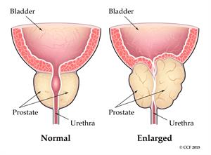 best angioplasty doctor in Kolkata