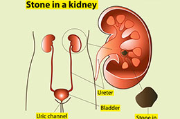 best angioplasty doctor in Kolkata